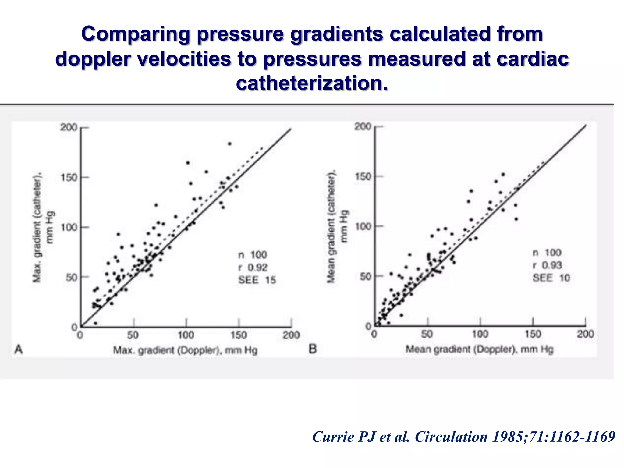 Comparing pressure gradients calculated from 
doppler velocities to pressures measured at cardiac 
catheterization. 
Currie PJ et al. Circulation 1985;71:1162-1169 
 