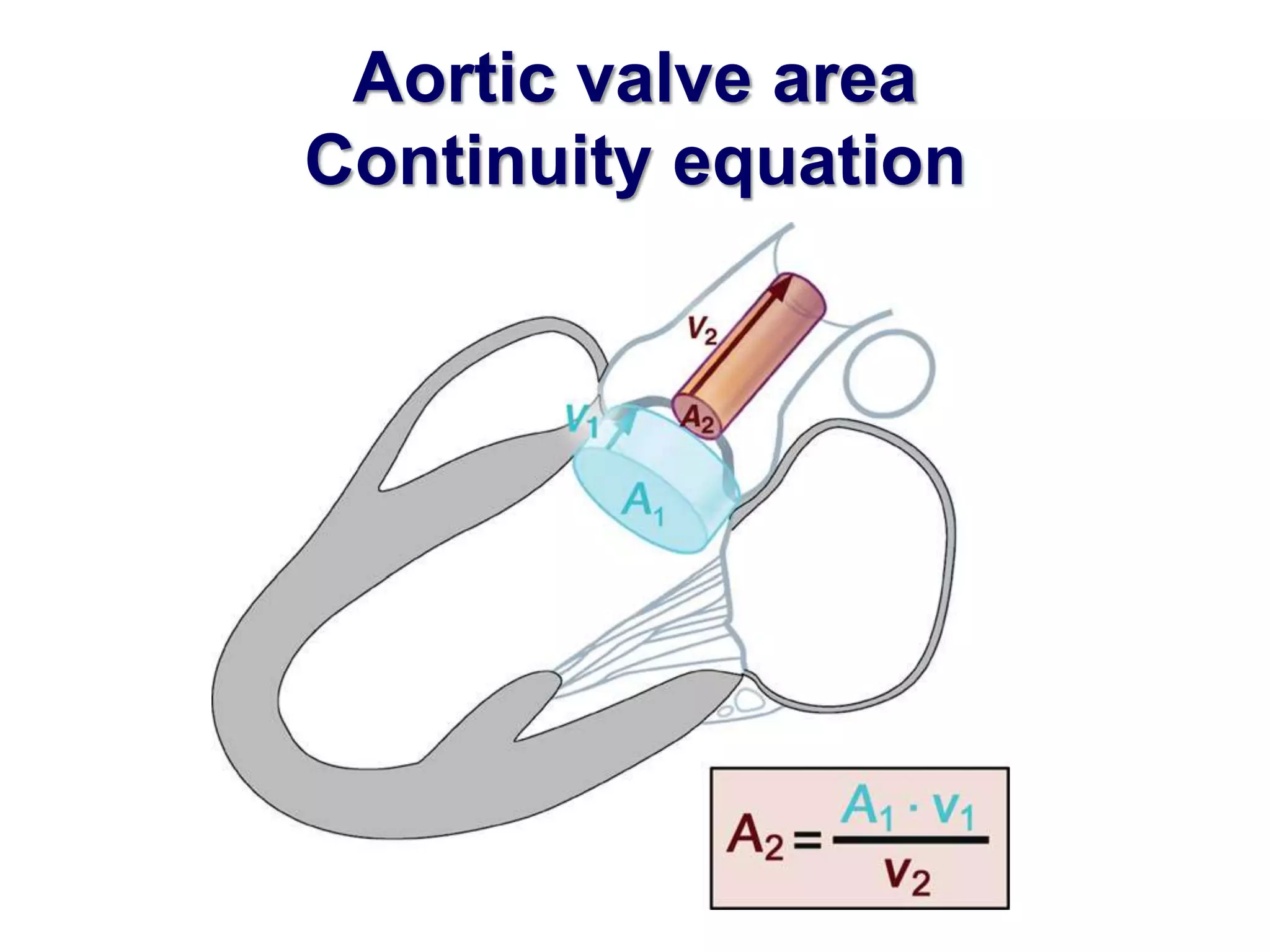 Aortic valve area 
Continuity equation 
 