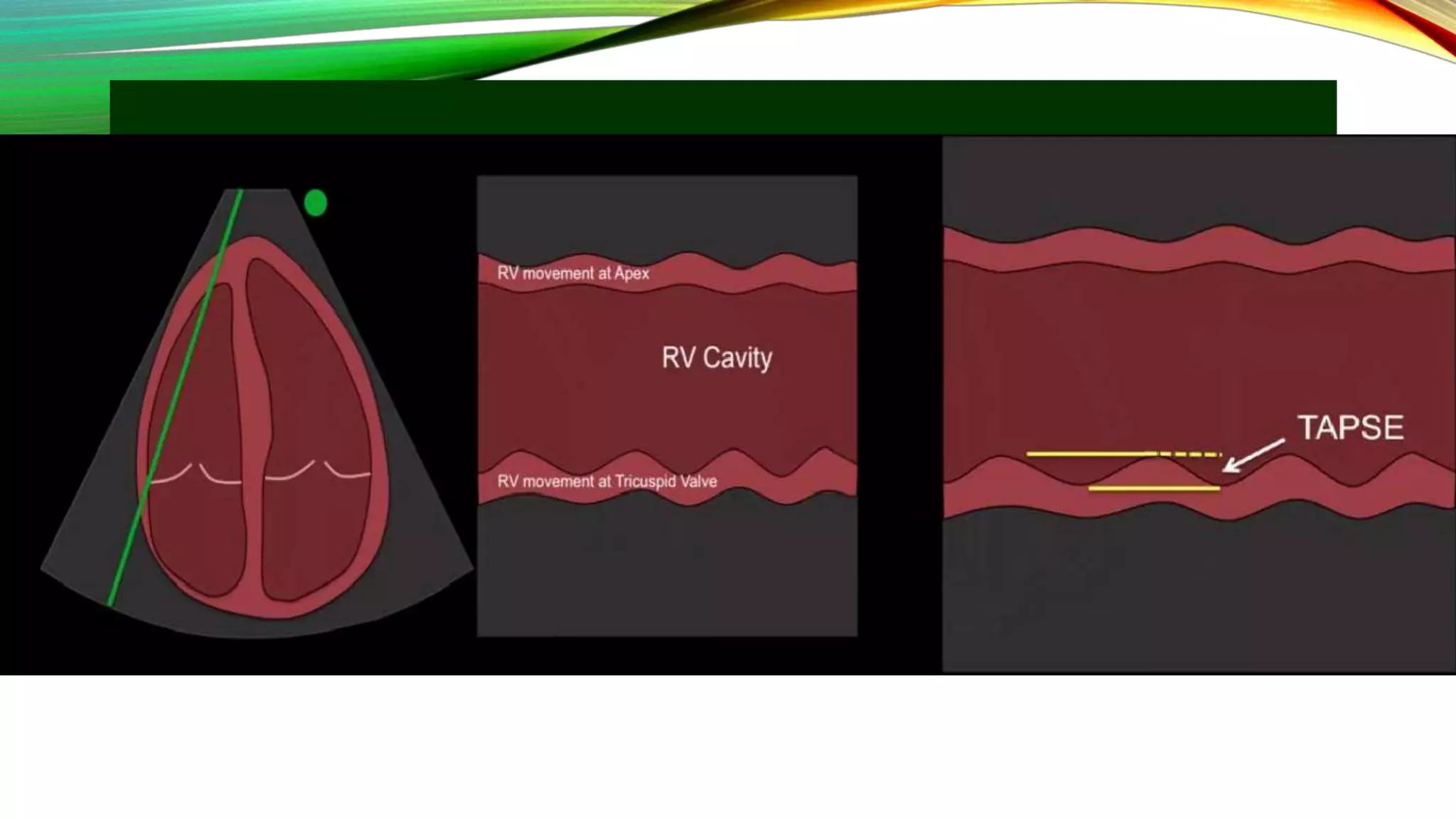 Echo assesment of rv function | PPTX
