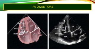 RV DIMENTIONS
 