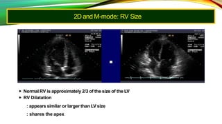 2D and M-mode: RV Size
▶ Normal RV is approximately 2/3 of the size of the LV
▶ RV Dilatation
: appears similar or larger than LV size
: shares the apex
 