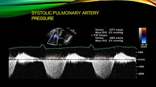 SYSTOLIC PULMONARY ARTERY
PRESSURE
 