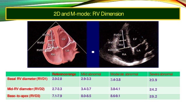 Echo assesment of rv function