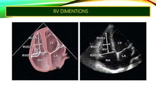 Pedestal Rvt Echo assesmentof rv function | PPTX