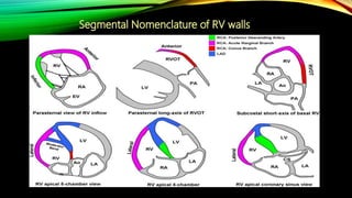 Echo assesmentof rv function | PPTX