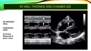 Echo assesmentof rv function | PPTX