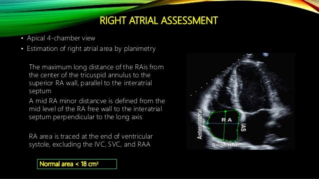 Reference values for mitral and tricuspid annular dimensions using two Echo assesmentof rv function