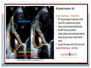 ECHO ASSESMENT OF RV FUNCTION AND PAH fin1.pptx