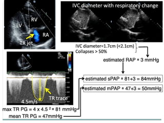 ECHO ASSESMENT OF RV FUNCTION AND PAH fin1.pptx
