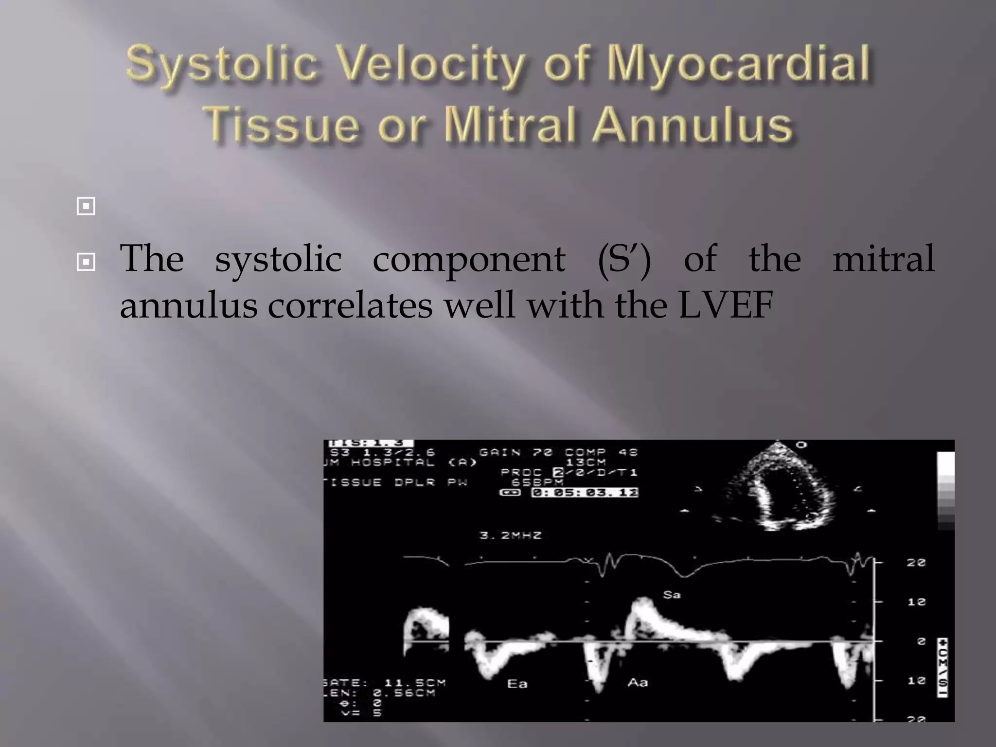 
 The systolic component (S’) of the mitral
annulus correlates well with the LVEF
 