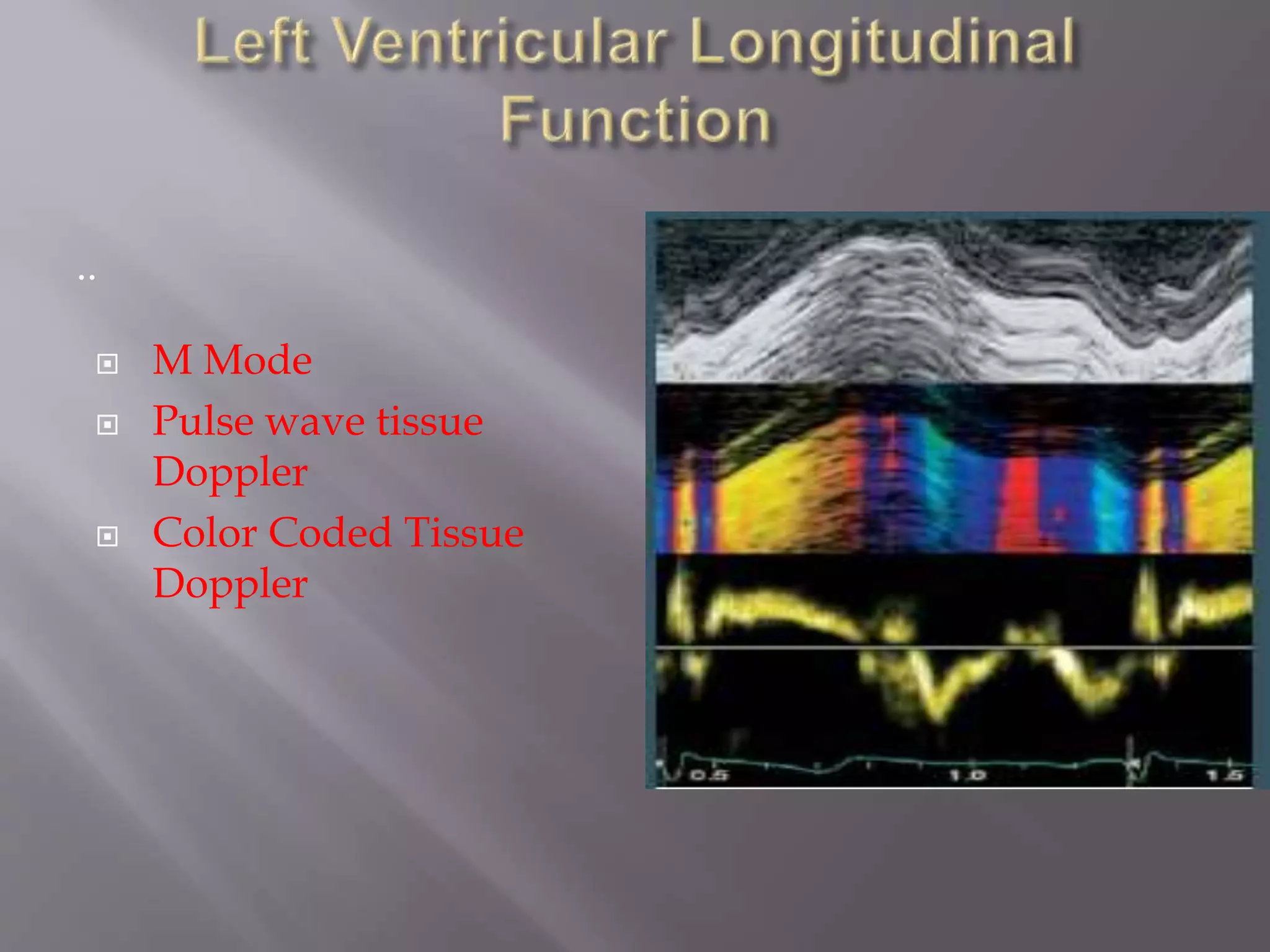 .. .
 M Mode
 Pulse wave tissue
Doppler
 Color Coded Tissue
Doppler
 