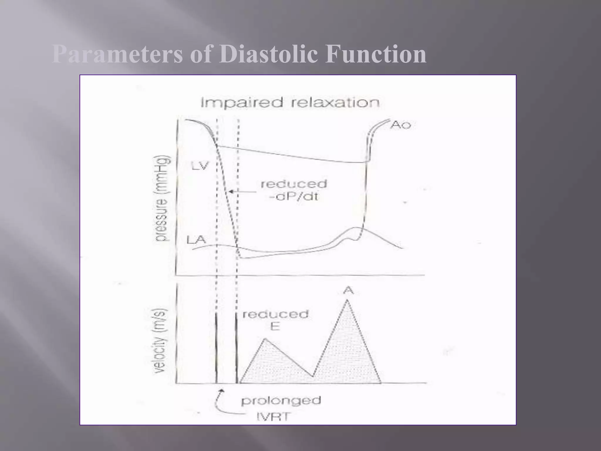 Parameters of Diastolic Function
 