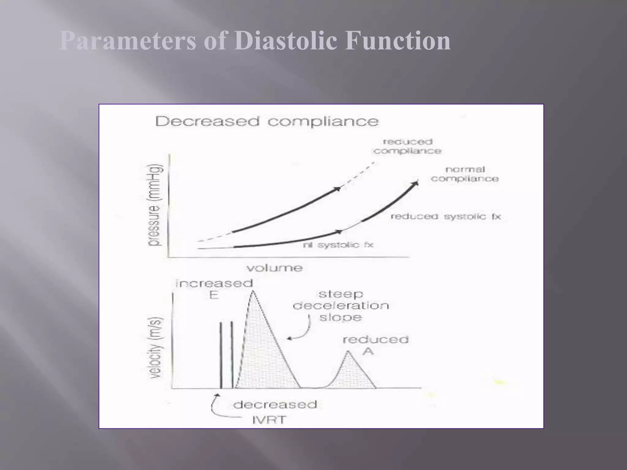 Parameters of Diastolic Function
 