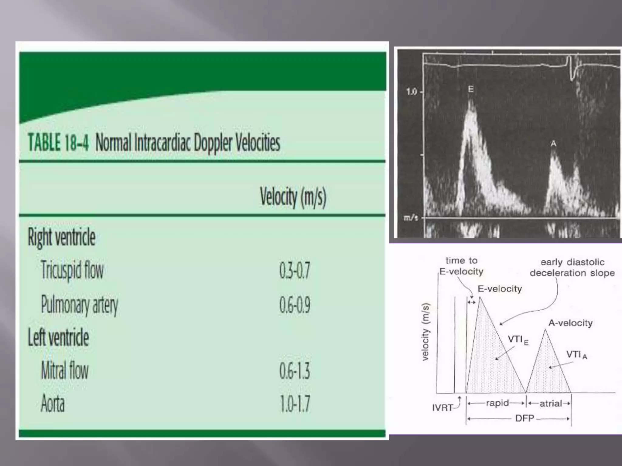 Left Ventricular Filling
 