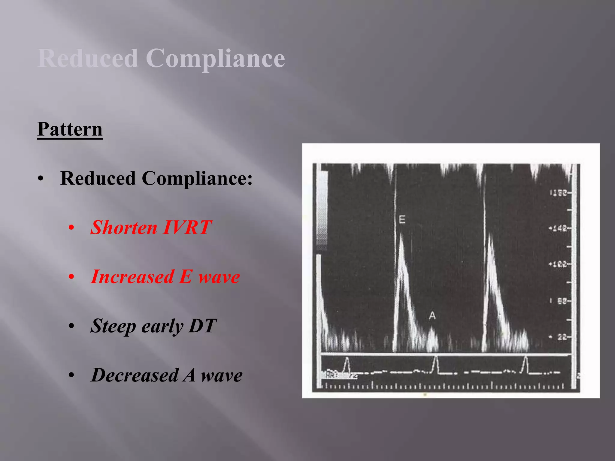 Pattern
• Reduced Compliance:
• Shorten IVRT
• Increased E wave
• Steep early DT
• Decreased A wave
Reduced Compliance
 