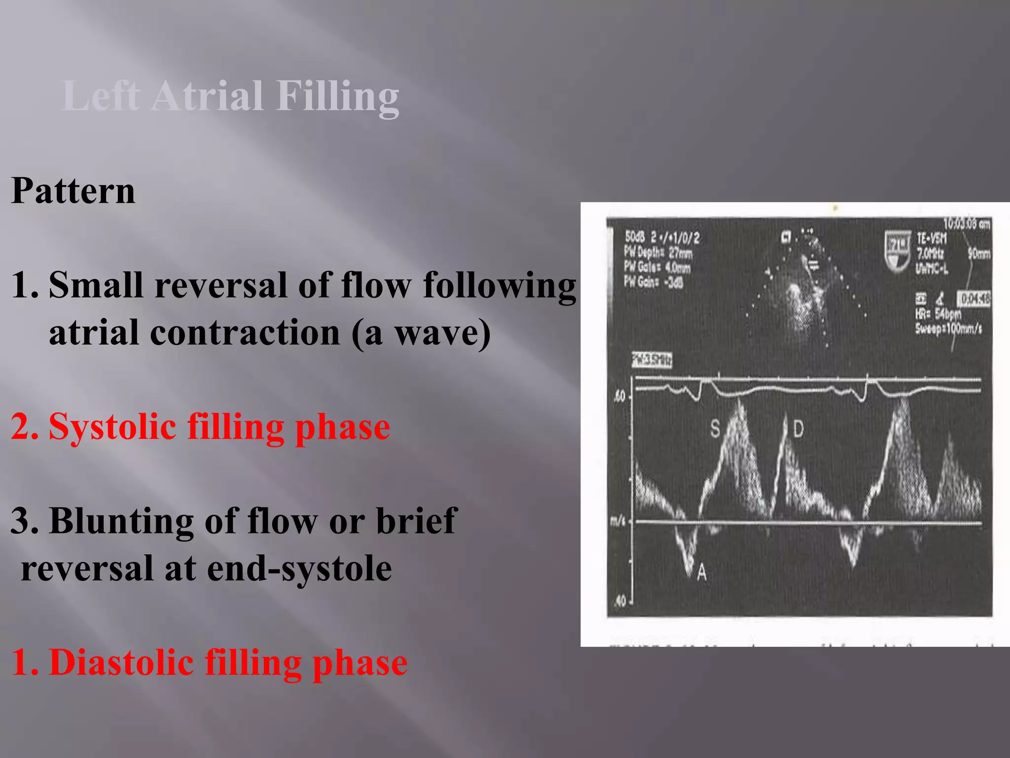 Pattern
1. Small reversal of flow following
atrial contraction (a wave)
2. Systolic filling phase
3. Blunting of flow or brief
reversal at end-systole
1. Diastolic filling phase
Left Atrial Filling
 