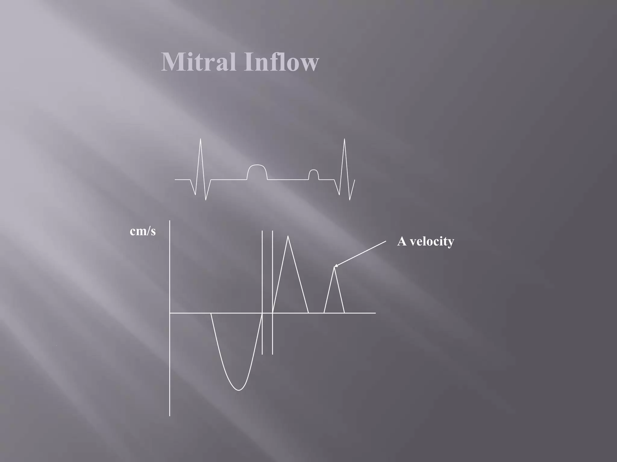 Mitral Inflow
cm/s
A velocity
 