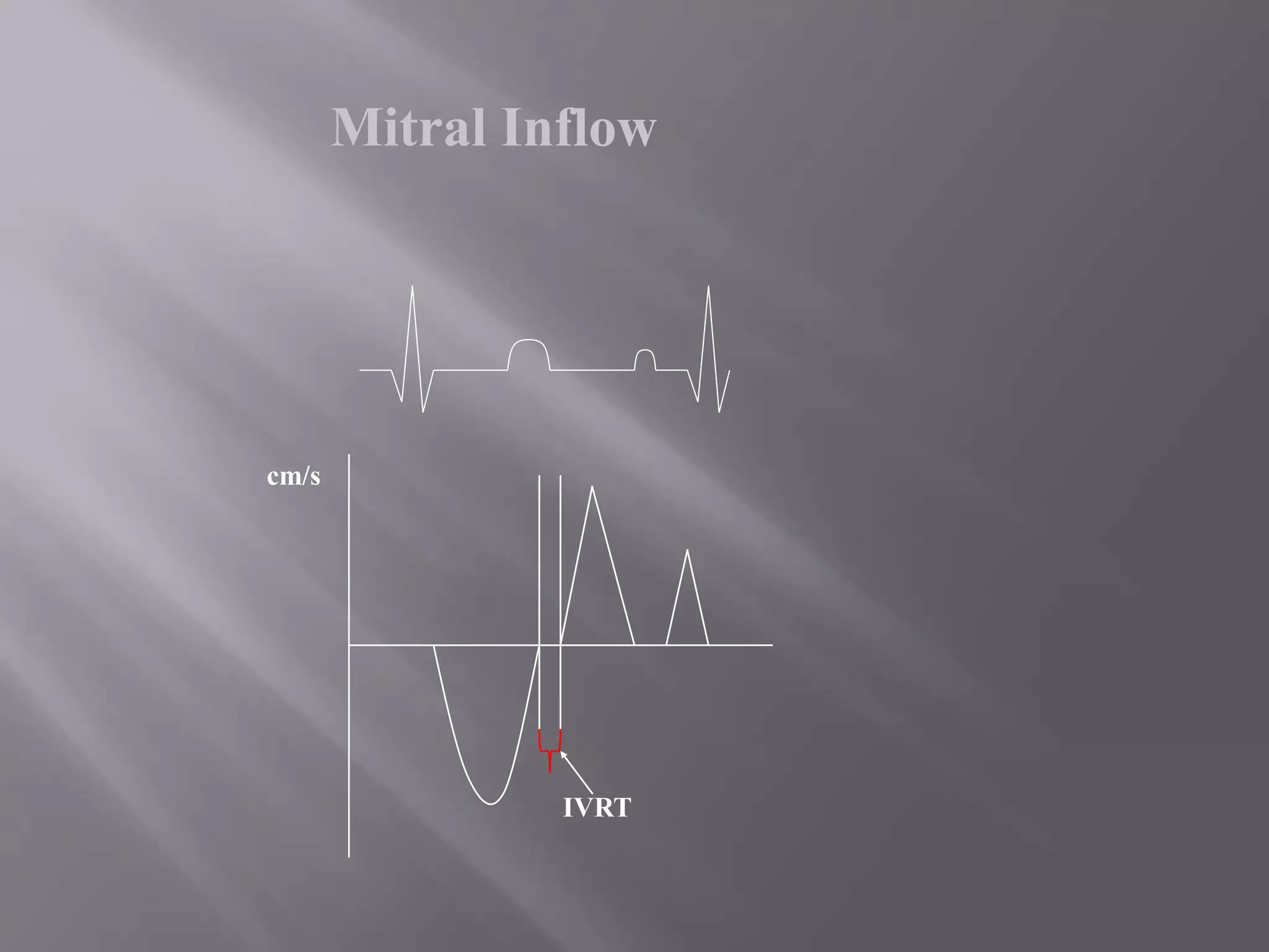 Mitral Inflow
cm/s
IVRT
 