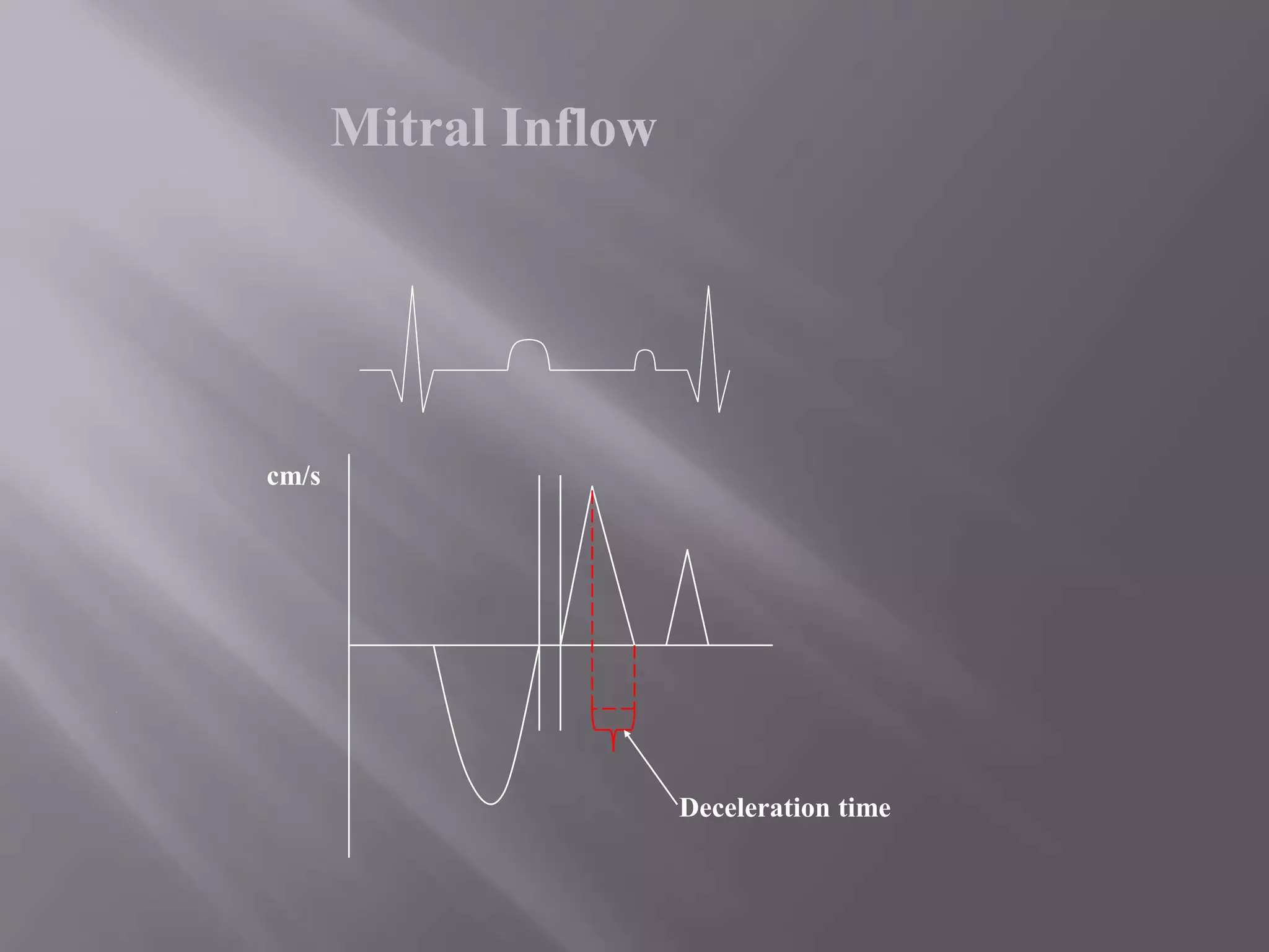 Mitral Inflow
cm/s
Deceleration time
 