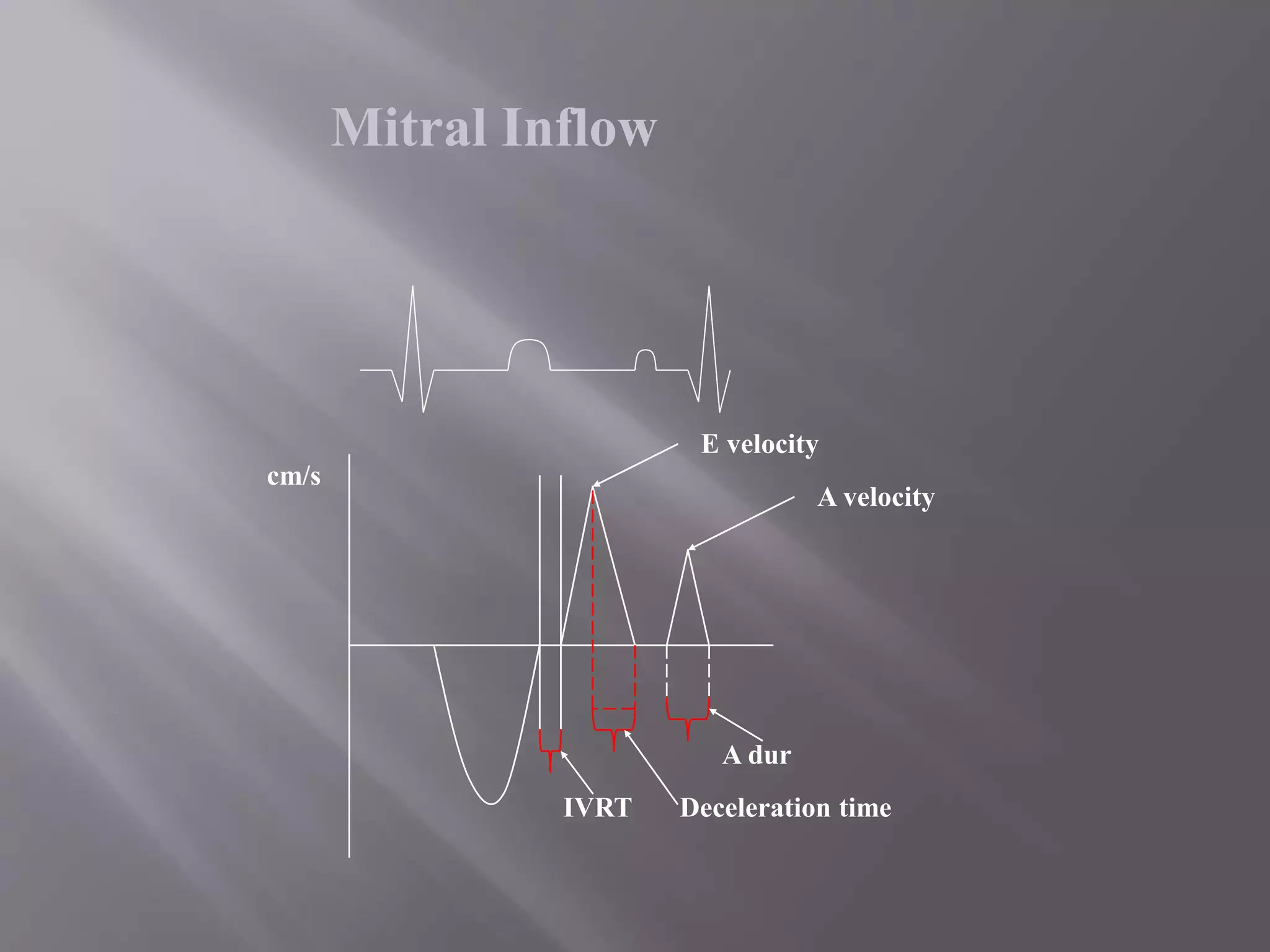 Mitral Inflow
cm/s
E velocity
A velocity
IVRT
A dur
Deceleration time
 