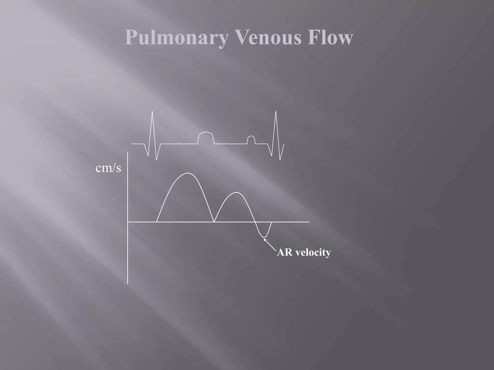 cm/s
AR velocity
Pulmonary Venous Flow
 