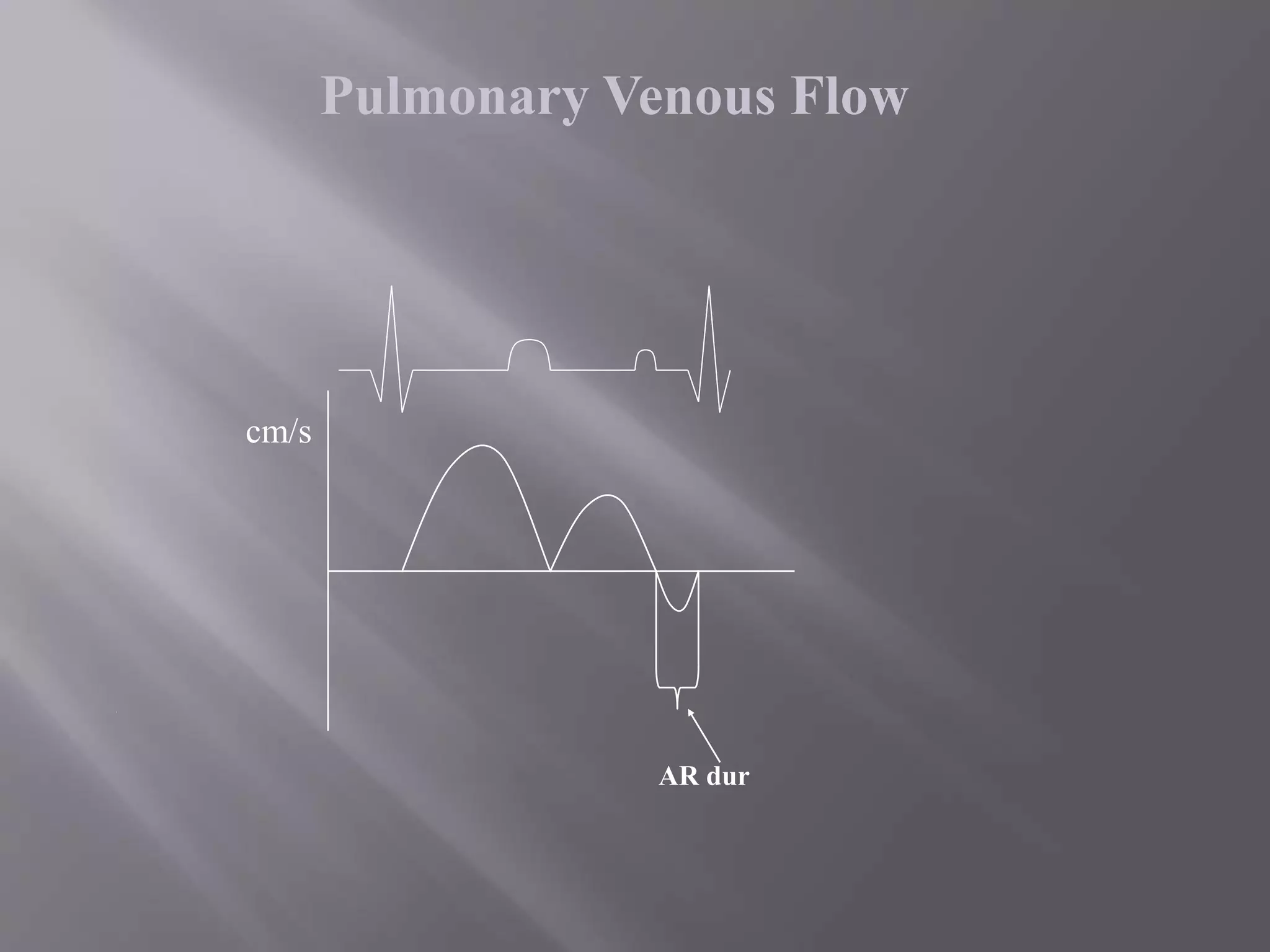 cm/s
AR dur
Pulmonary Venous Flow
 