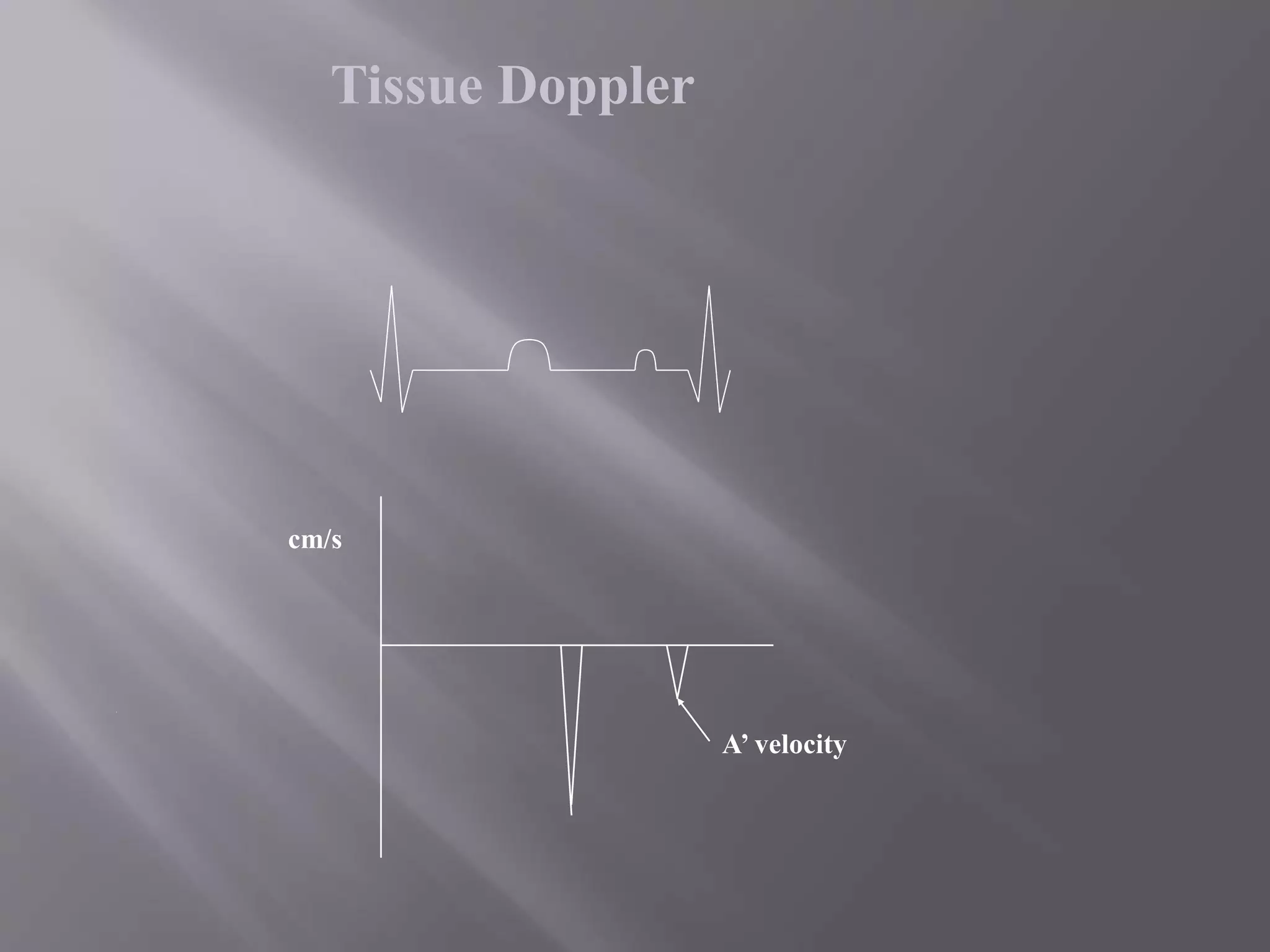 cm/s
A’ velocity
Tissue Doppler
 