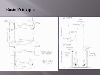 Echocardiographic assesment of systolic and diastolic dysfunction | PPTX