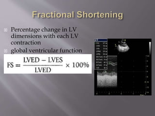 Echocardiographic assesment of systolic and diastolic dysfunction | PPTX