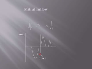 Ivrt Normal Values Echocardiographic assesment of systolic and diastolic dysfunction | PPTX
