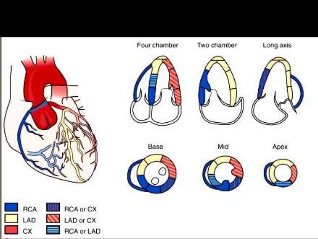 Echo assessment of lv systolic function and swma