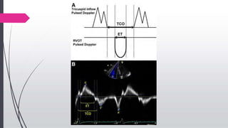 echoassessmentofrvfunction-190104172505.pptx