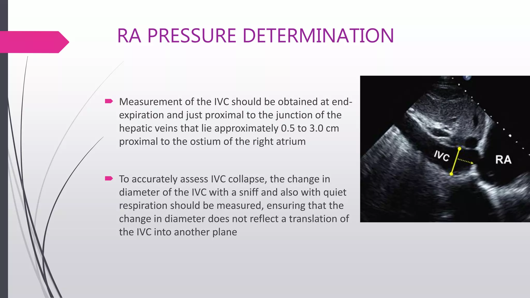 RA PRESSURE DETERMINATION
 Measurement of the IVC should be obtained at end-
expiration and just proximal to the junction of the
hepatic veins that lie approximately 0.5 to 3.0 cm
proximal to the ostium of the right atrium
 To accurately assess IVC collapse, the change in
diameter of the IVC with a sniff and also with quiet
respiration should be measured, ensuring that the
change in diameter does not reflect a translation of
the IVC into another plane
 