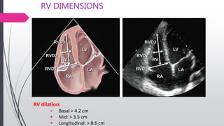 RV DIMENSIONS
RV dilation:
 Basal > 4.2 cm
 Mid: > 3.5 cm
 Longitudinal: > 8.6 cm
 