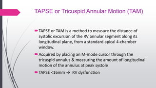 TAPSE or Tricuspid Annular Motion (TAM)
TAPSE or TAM is a method to measure the distance of
systolic excursion of the RV annular segment along its
longitudinal plane, from a standard apical 4-chamber
window.
Acquired by placing an M-mode cursor through the
tricuspid annulus & measuring the amount of longitudinal
motion of the annulus at peak systole
TAPSE <16mm → RV dysfunction
 