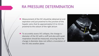 RA PRESSURE DETERMINATION
 Measurement of the IVC should be obtained at end-
expiration and just proximal to the junction of the
hepatic veins that lie approximately 0.5 to 3.0 cm
proximal to the ostium of the right atrium
 To accurately assess IVC collapse, the change in
diameter of the IVC with a sniff and also with quiet
respiration should be measured, ensuring that the
change in diameter does not reflect a translation of
the IVC into another plane
 