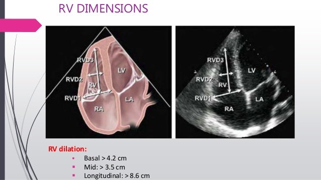 echo-assessment-of-rv-function