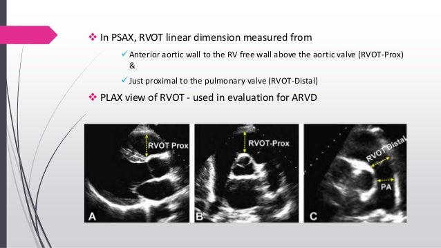 echo-assessment-of-rv-function