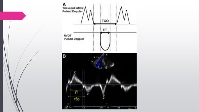 echo-assessment-of-rv-function