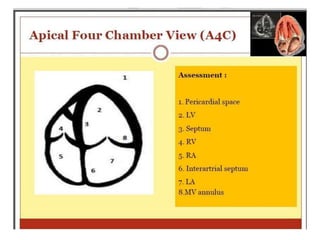 Basics of echocardiography | PDF