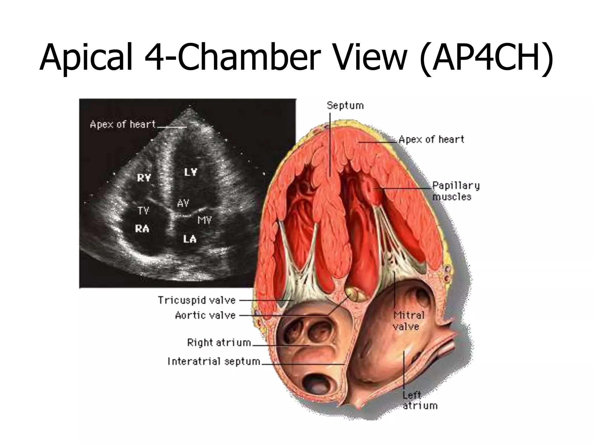Apical 4-Chamber View (AP4CH)
 