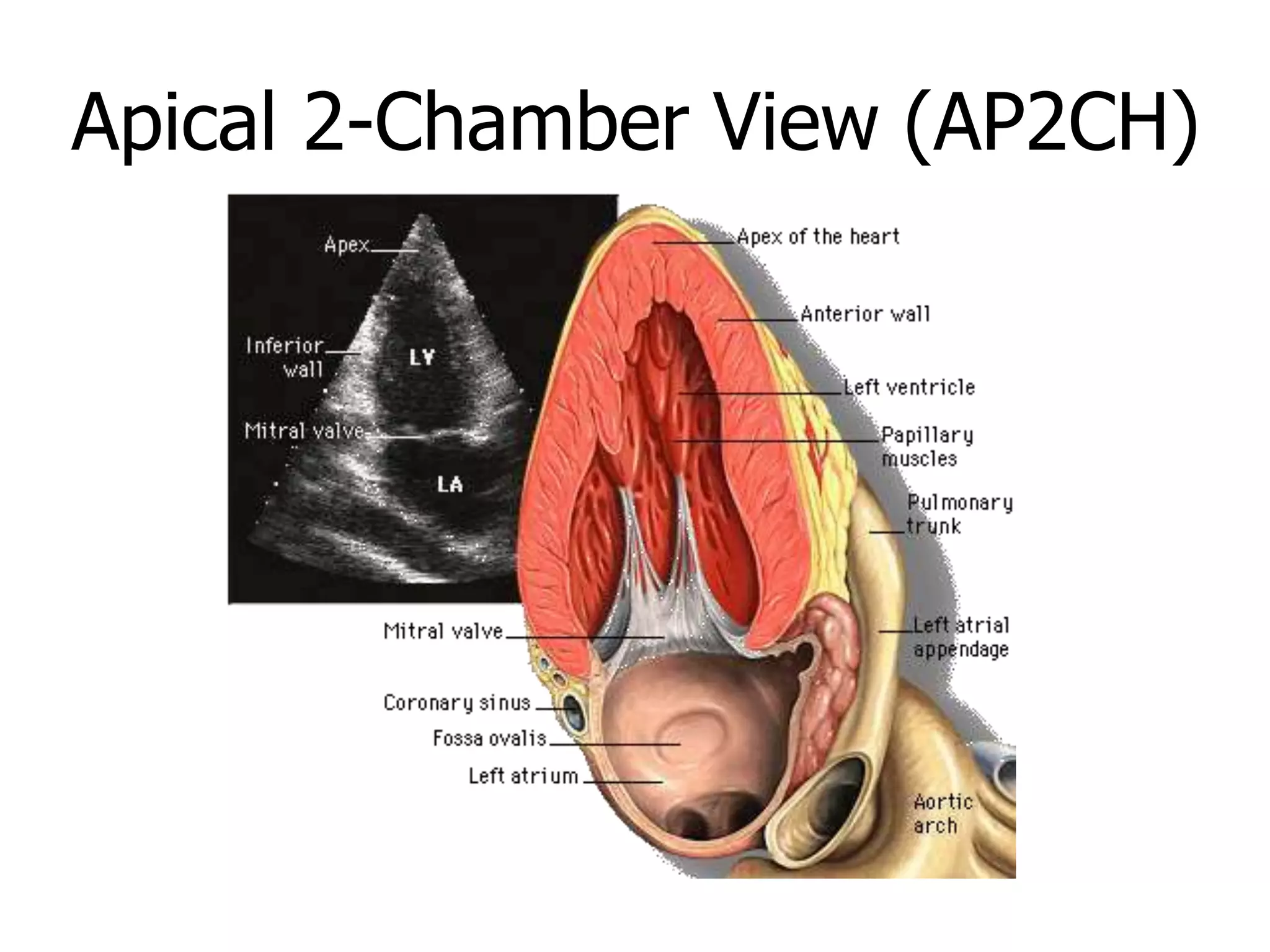 Apical 2-Chamber View (AP2CH)
 