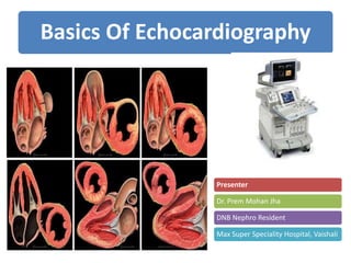 Basics Of Echocardiography
Presenter
Dr. Prem Mohan Jha
DNB Nephro Resident
Max Super Speciality Hospital, Vaishali
 