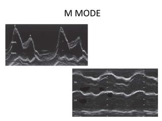 2D ECHO Basics | PPTX