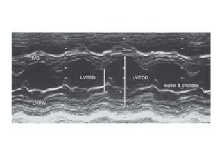 2D ECHO Basics | PPTX