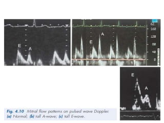 2D ECHO Basics | PPTX