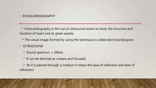ECHO BASICS.pptx
