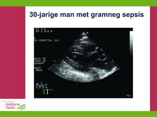 30-jarige man met gramneg sepsis 