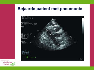 Bejaarde patient met pneumonie 