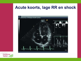 Acute koorts, lage RR en shock 
